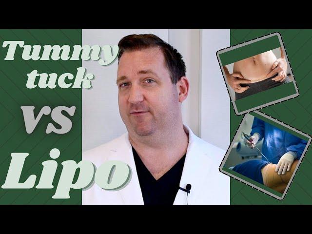 What is the difference between a tummy tuck (abdominoplasty) and Liposuction?