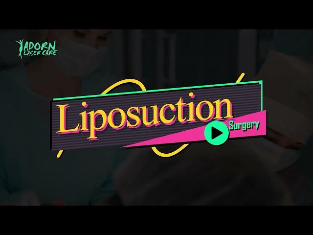 Liposuction at Adorn Laser Care | Adorn Laser Care | Liposuction