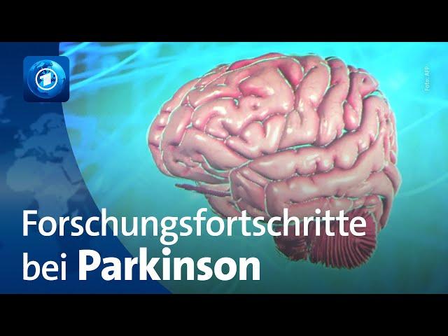 Welt-Parkinson-Tag: Was sich in der Forschung tut