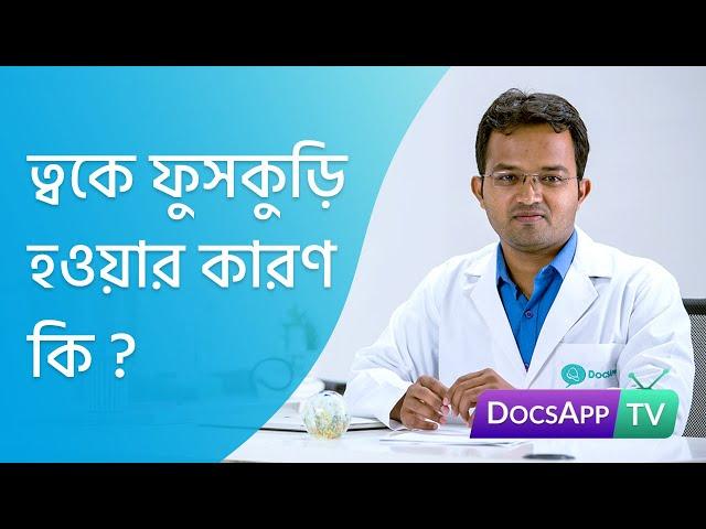 ত্বকে ফুসকুড়ি  হওয়ার  কারণ  কি? #AsktheDoctor