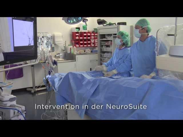 Gefässmissbildung AV-Malformation - Zentrum für Neuroradiologie - Klinik Hirslanden