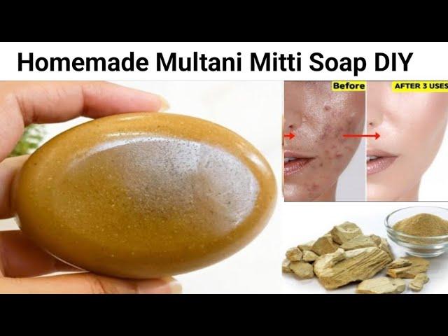 100% Natural Multani Mitti Soap to get rid of Acne, Pimples & Dark Spots | Skin Whitening Soap DIY