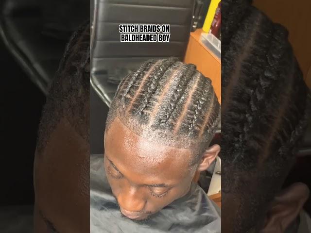 STITCH BRAIDS ON BALDHEADED BOY