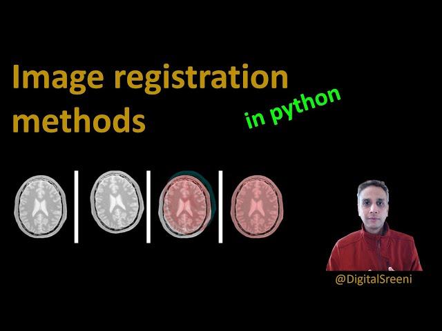 120 - Image registration methods in python