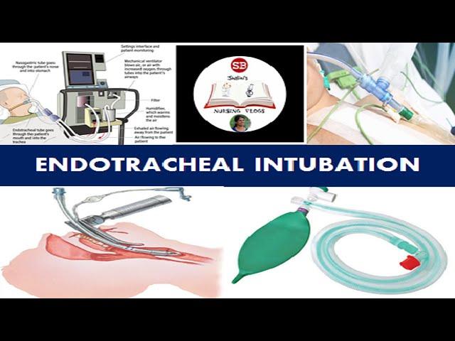 ENDOTRACHEAL INTUBATION- Types, Indications, Procedure,Medical and Nursing Management I QUICK REVIEW