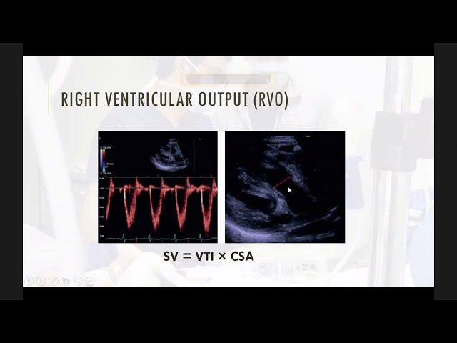 Neonatal Echocardiography (part 2), by Dr Ahmed Tharwat