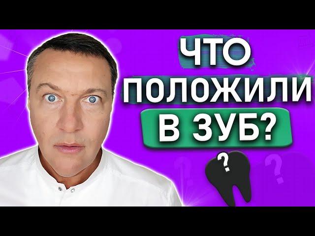 Какое ЛЕКАРСТВО кладут под временную пломбу? Лечение пульпита и периодонтита под временной пломбой.