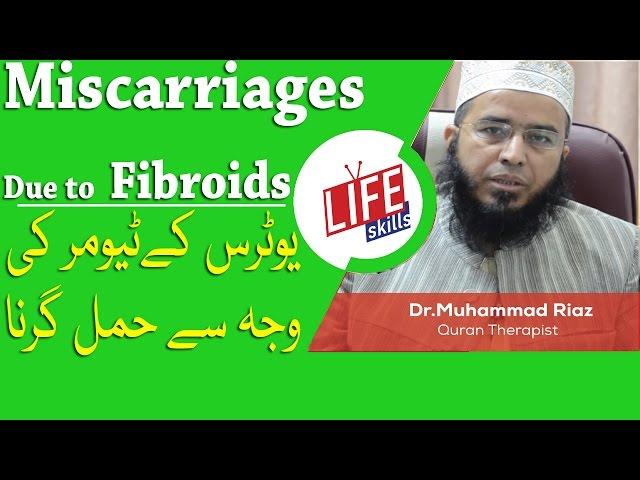 Miscarriages Due to Fibroids, Treatment with Quran Therapy | Life Skills TV