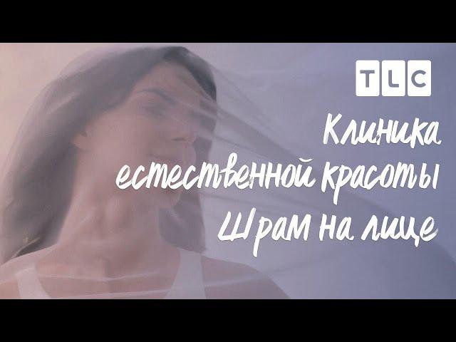 Шрам на лице | Клиника естественной красоты | TLC