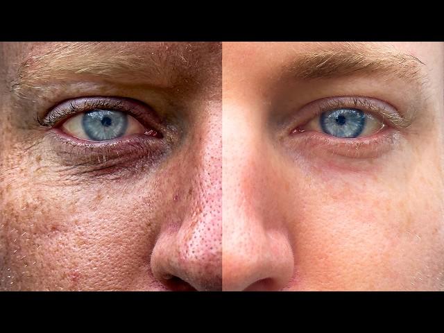 This Controversial Supplement ACTUALLY Reverses Wrinkles