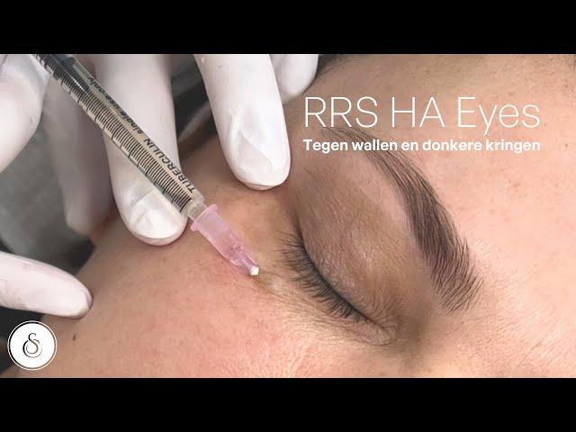 RRS HA eyes treatment l For puffy eyes & dark cirkles