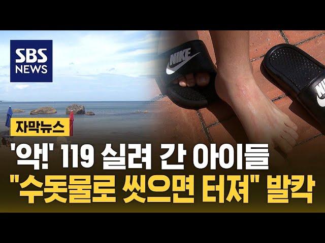 '악!' 119 실려 간 아이들…"심하면 사망" 공포의 물놀이 (자막뉴스) / SBS