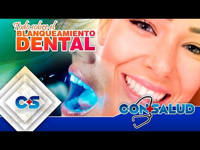 BLANQUEAMIENTO DENTAL