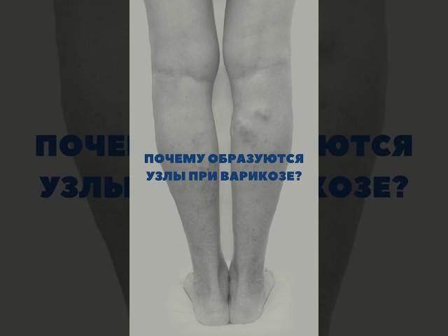 Иногда эндовенозную лазерную коагуляцию дополняют минифлебэктомией.