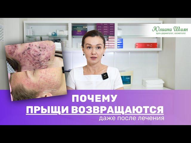 Как вылечить акне и розацеа навсегда. Это важно знать каждому человеку с проблемной кожей.