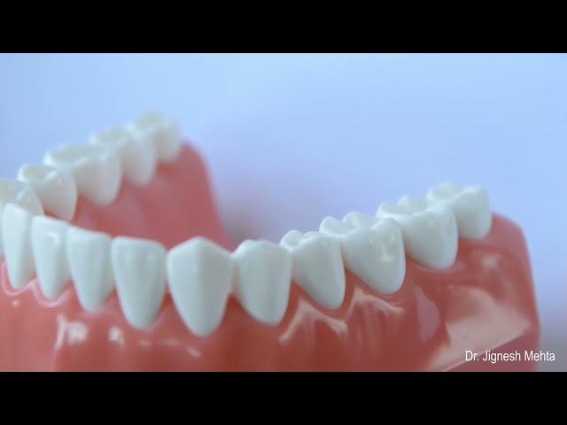 Correct Brushing Technique Animation by Dr Jignesh Mehta