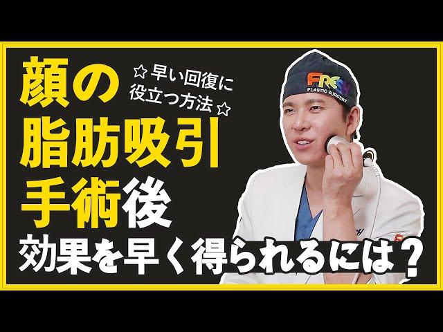 【顔脂肪吸引】 小顔になるために受けた脂肪吸引手術！より早めに効果を得られる方法とは⁈　#小顔効果  #顔脂肪吸引 ＃高周波管理