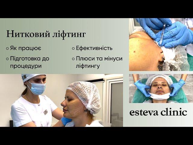 Нитковий ліфтинг в Esteva Clinic