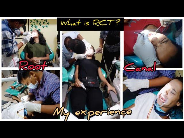 My Experience About RCT️I try to clear ur all queries #rootcanal#glamgirltanyafam