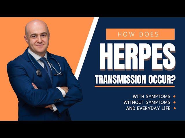 What is my chance of getting (or passing) herpes or herpes transmission rate? Expert doctor explains