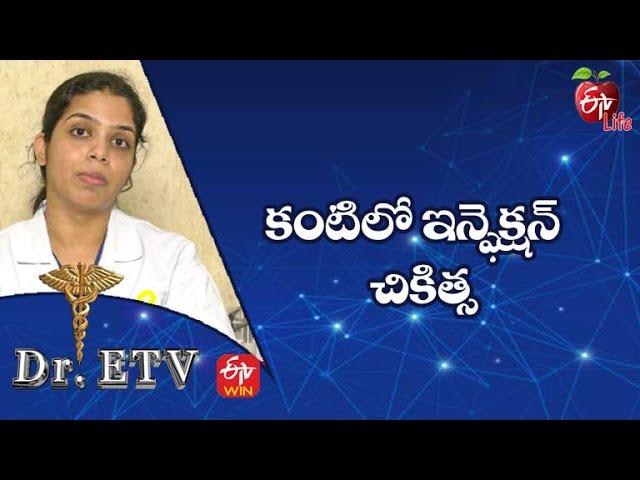 Eye Infection - Treatment | కంటిలో ఇన్ఫెక్షన్ - చికిత్స | Dr.ETV | 20th Sep 2022 | ETV Life