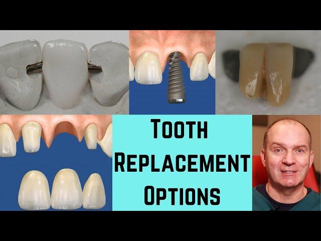 5 ways to replace a missing front tooth.