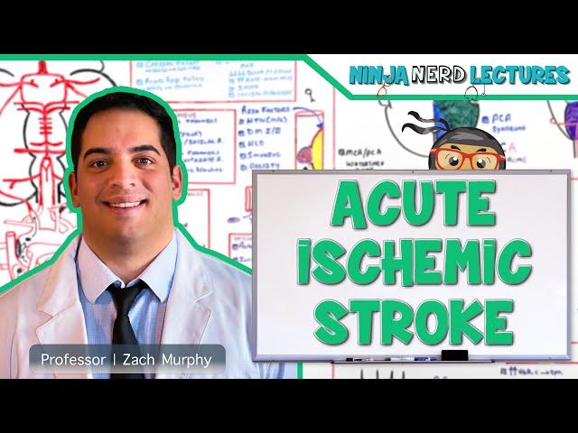 Acute Ischemic Stroke: Etiology, Pathophysiology, Clinical Features, Diagnostics, Treatment