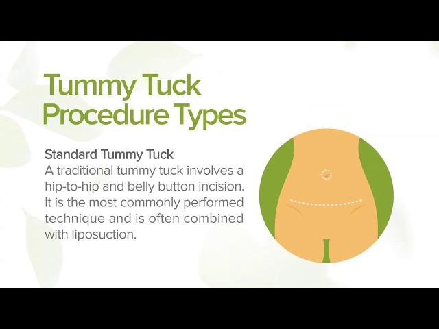 Tummy Tuck: Benefits, Types and Recovery | Marin Aesthetics