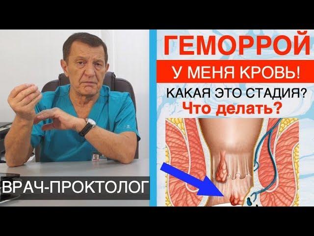 ГЕМОРРОЙ - КРОВЬ МАЗКАМИ, РАЗ в КВАРТАЛ. Какая это стадия геморроя и что делать?