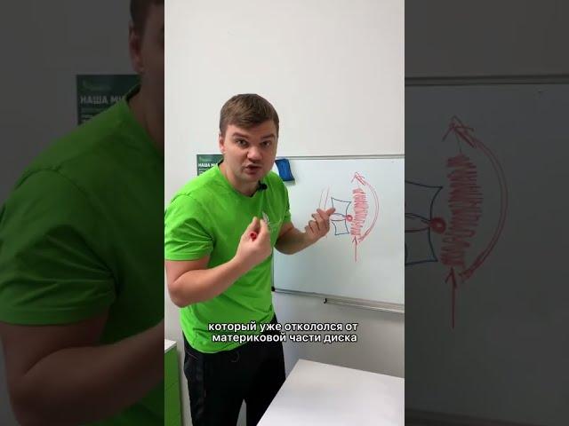 Как рассасывается межпозвоночная грыжа? #Shorts