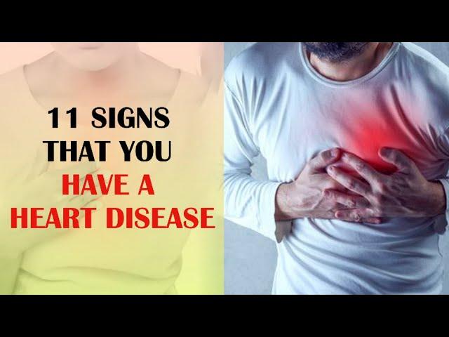 11 Signs That You Have a Heart Disease