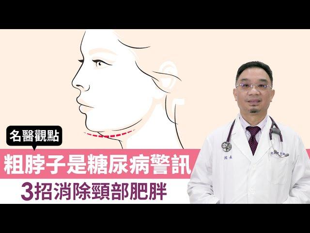 【名醫觀點】粗脖子是糖尿病、心臟病警訊！頸圍超過16、17吋當心了 名醫授3招消除頸部肥胖