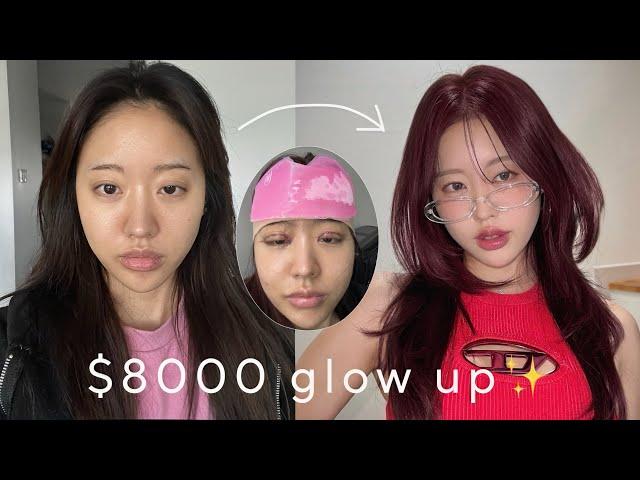 $8000 EXTREME glow up in Korea (Plastic surgery, skin clinic, hair, nail, profile pic, idol makeup)