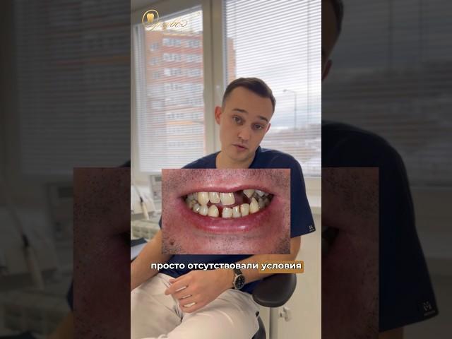 Кейс: полное восстановление функции и эстетики зубов #стоматологиякалуга #доктор #dentist