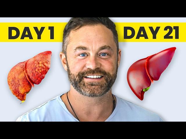 How to REVERSE your Fatty Liver (21 Day Complete Plan)