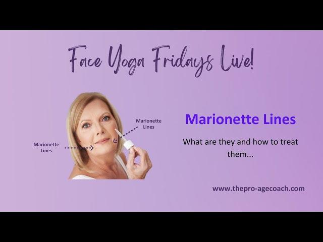 Marionette Lines - What are they and how to treat them...