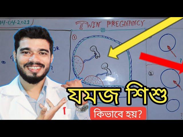 যমজ সন্তান কিভাবে হয় | What is Dichorionic and Monochorionic twin pregnancy