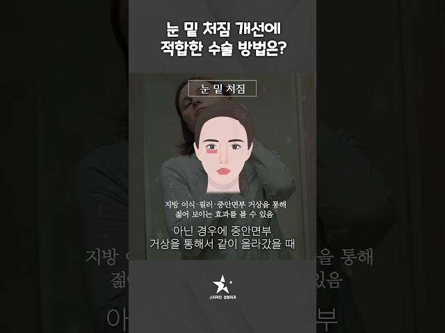 눈 밑 처짐으로 노화되어 보이는 눈! 어떻게 개션해야 할까? #안면거상 #눈밑지방 #눈성형
