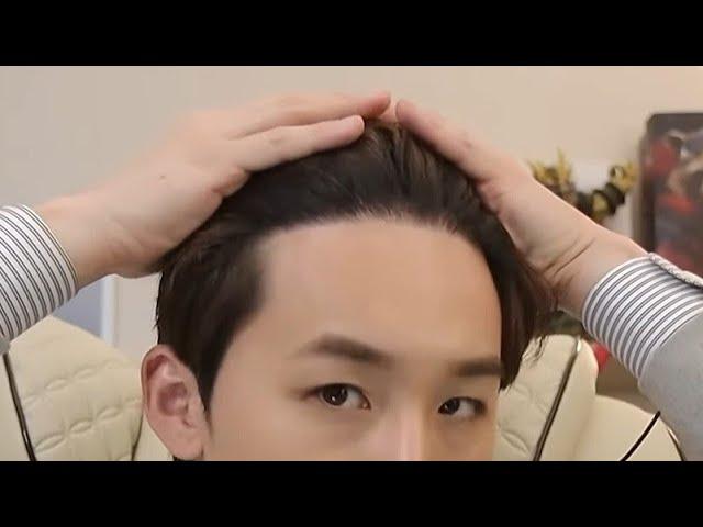 Top 6 Hair Transplant Side Effects