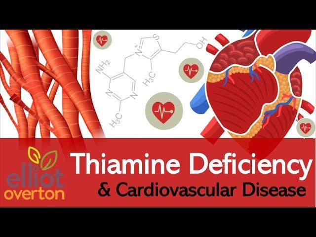 Vitamin B1 (Thiamine) Deficiency: Cardiovascular & Circulatory Diseases