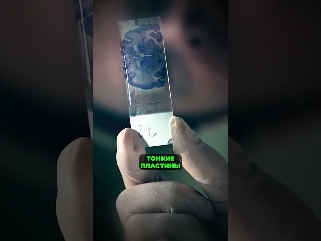 Кто украл  мозг Эйнштейна?