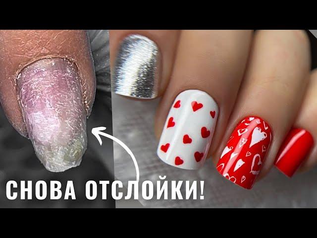 ОТСЛОЙКИ НА НОГТЯХ! В чем причина? ДИЗАЙН ногтей на 14 ФЕВРАЛЯ