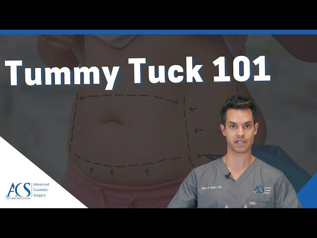 Tummy Tuck Surgery Explained By Plastic Surgeon