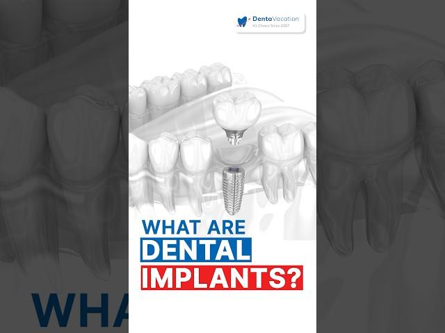 Dental Implants in Thailand: Implantologist in Thailand Explains It All!