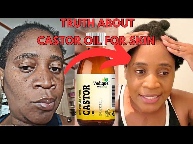 Castor Oil for your face shocking Truth About Castor Oil On The Skin/  Benefits Of Castor  Oil