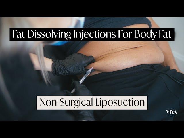 Non-Surgical Liposuction | How To Get A Flat Stomach (2021)