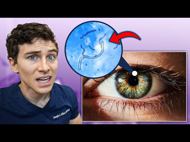 The Dangers of Eye Floaters: When to Worry