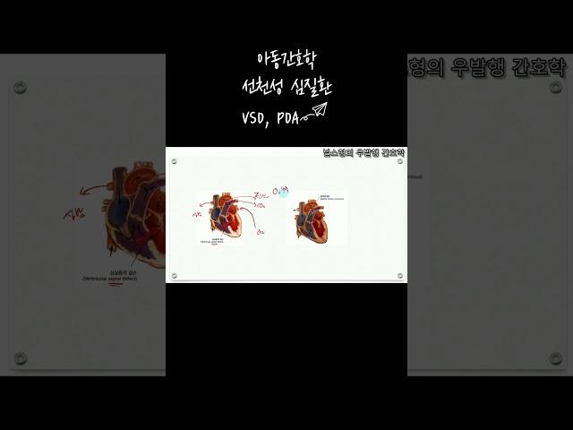 널스형의 우발행 간호학 아동간호 단원별문제 고위험신생아 선천성 심질환 1. #간호학  #간호학과