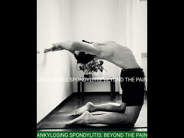 How yoga Can Help Beat #ankylosingspondylitis: #ytshorts   #feed #feedshorts #yshorts #shorts #trend