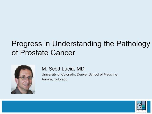 Progess in Understanding Pathology of Prostate Cancer